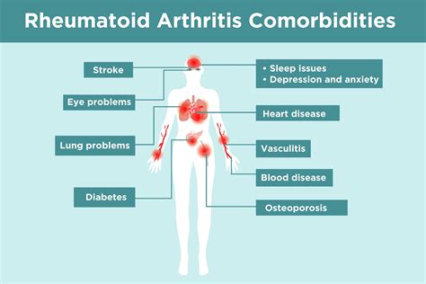 affected by rheumatoid arthritis